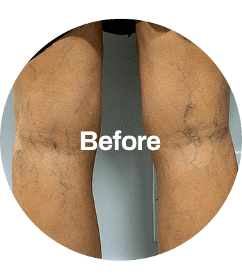 BEFORE_AFTER-min BEFORE_AFTER_2-min